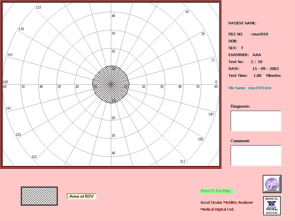 OMA: Field of BSV